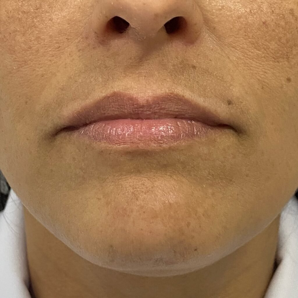 Instagram post from dra.paulacastro. This post is in position 3.