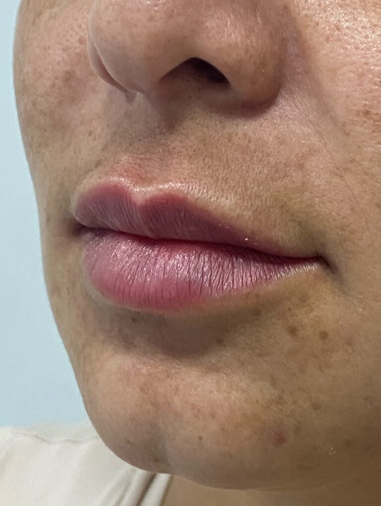 Instagram post from dra.paulacastro. This post is in position 3.