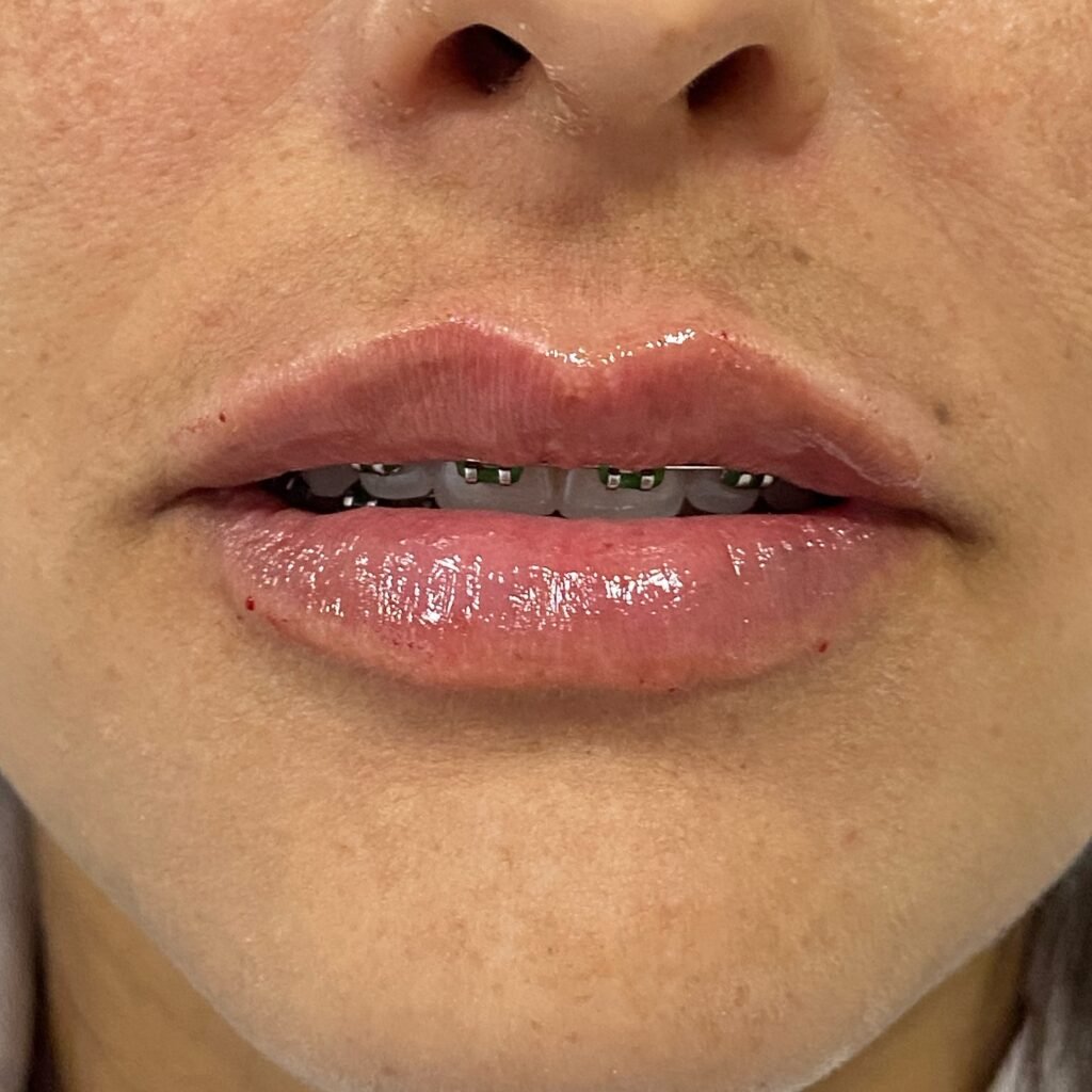 Instagram post from dra.paulacastro. This post is in position 2.