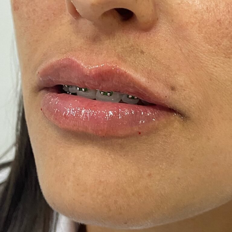 Instagram post from dra.paulacastro. This post is in position 5.