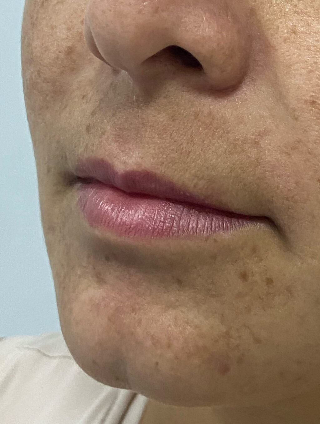 Instagram post from dra.paulacastro. This post is in position 1.