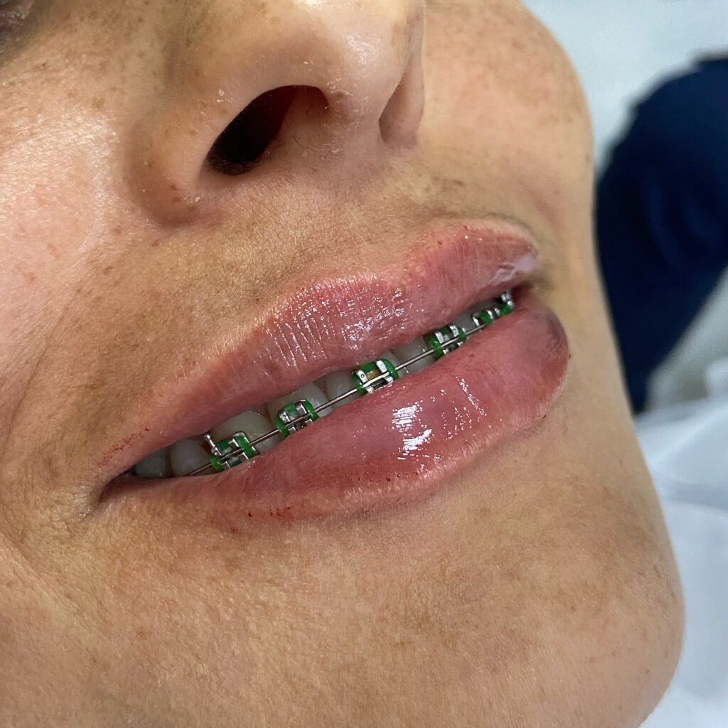 Instagram post from dra.paulacastro. This post is in position 4.