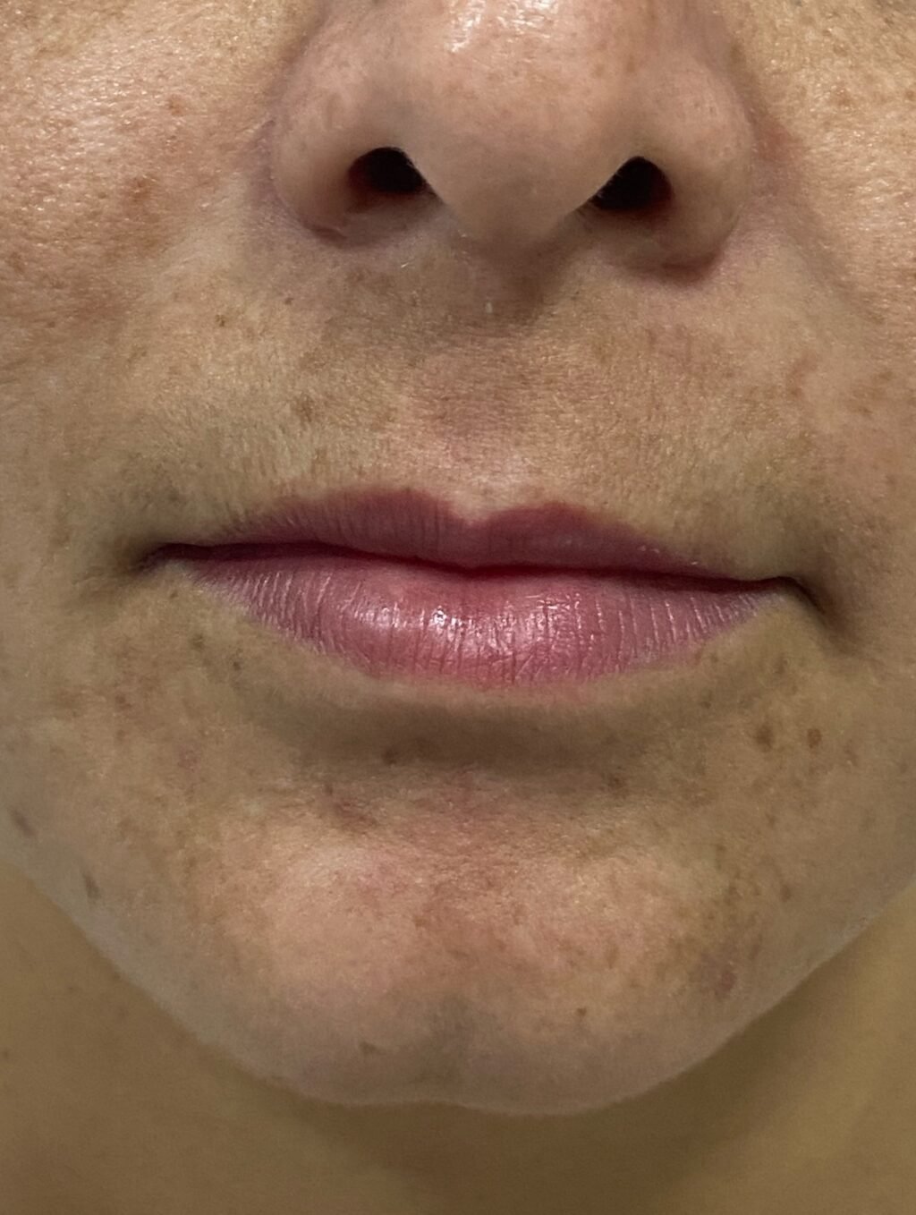 Instagram post from dra.paulacastro. This post is in position 3.