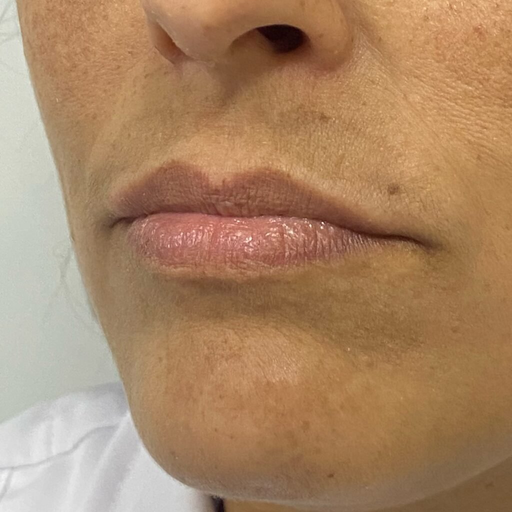 Instagram post from dra.paulacastro. This post is in position 1.